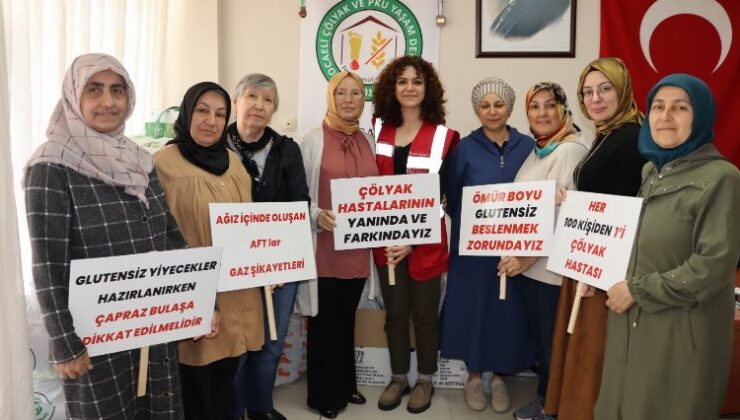 Kocaeli İzmit Belediyesi Çölyak ve PKU hastalarına özel gıda desteğine başladı